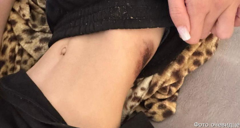 На Камчатке прокуратура проверяет воскресное ДТП, в котором служебный автомобиль сбил ребенка