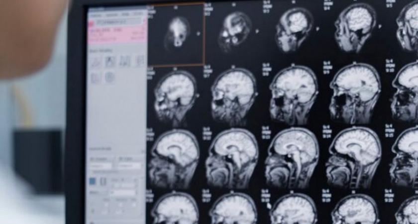 Обследование на аппарате МРТ на Камчатке должны стать доступными — Владимир Солодов