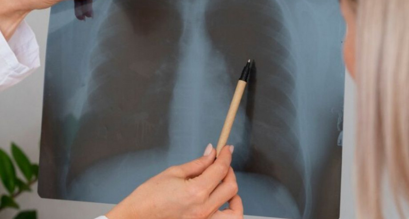 Что мешает работе легких? Рассказывают врачи-пульманологи