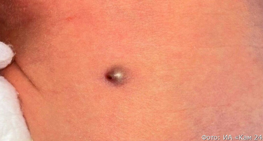 Россиянка родила малыша с пулей в животе