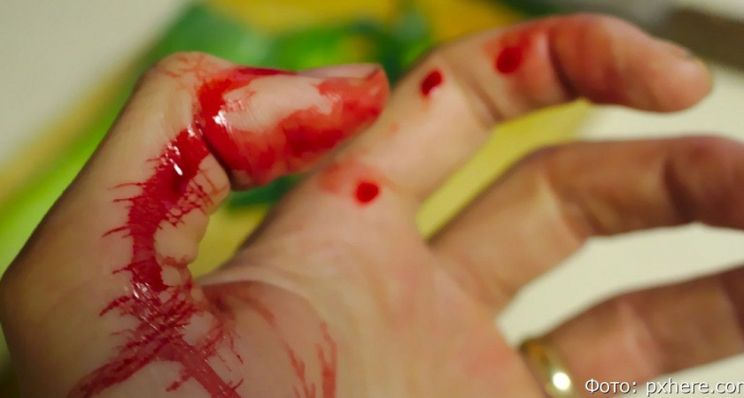 Жительнице камчатского посёлка грозит срок за убийство сожителя