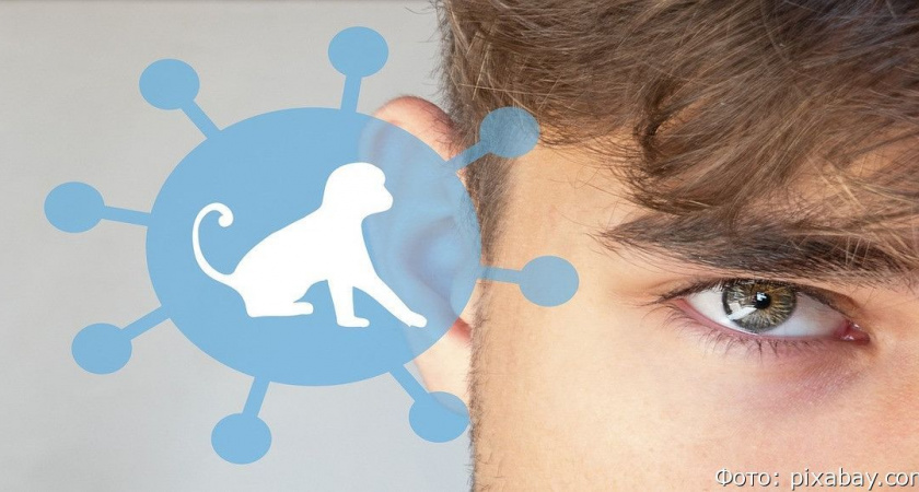 От оспы обезьян россиян спасут традиционные ценности, заявила глава Роспотребнадзора