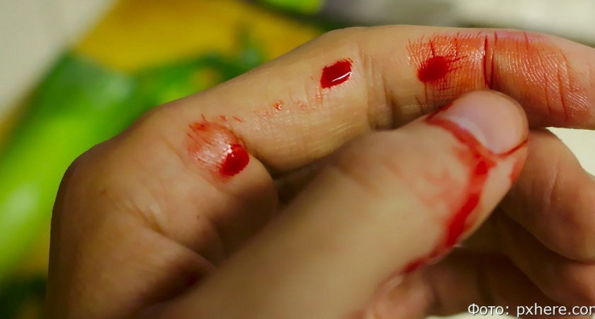 На Камчатке мильковчанка в пьяной ссоре всадила нож в грудь сожителя