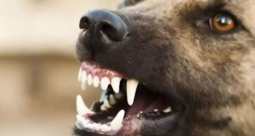 Бастрыкин взял на контроль расследование нападения бродячей собаки на ребёнка в Камчатском крае