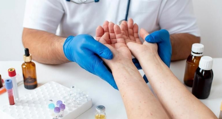 Камчатские медики призывают жителей избегать чрезмерного загара