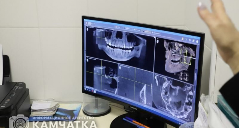 Камчатские врачи рассказали, какой щеткой лучше чистить зубы