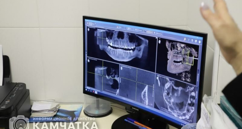 Камчатские стоматологи предупреждают: гнилые зубы – одна из причин артроза
