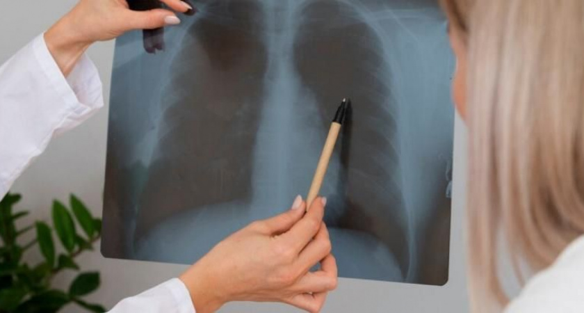 24 марта – Всемирный день борьбы с туберкулезом